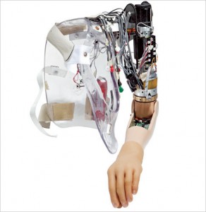 bionic-arm