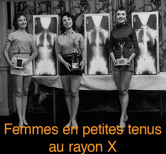 tumblr-erotique-rayon-x